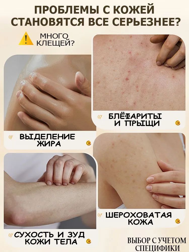 SUSUVETA гель для душа от прыщей, черных точек и акне, салициловая кислота, глубокое очищение кожи тела, 500 мл