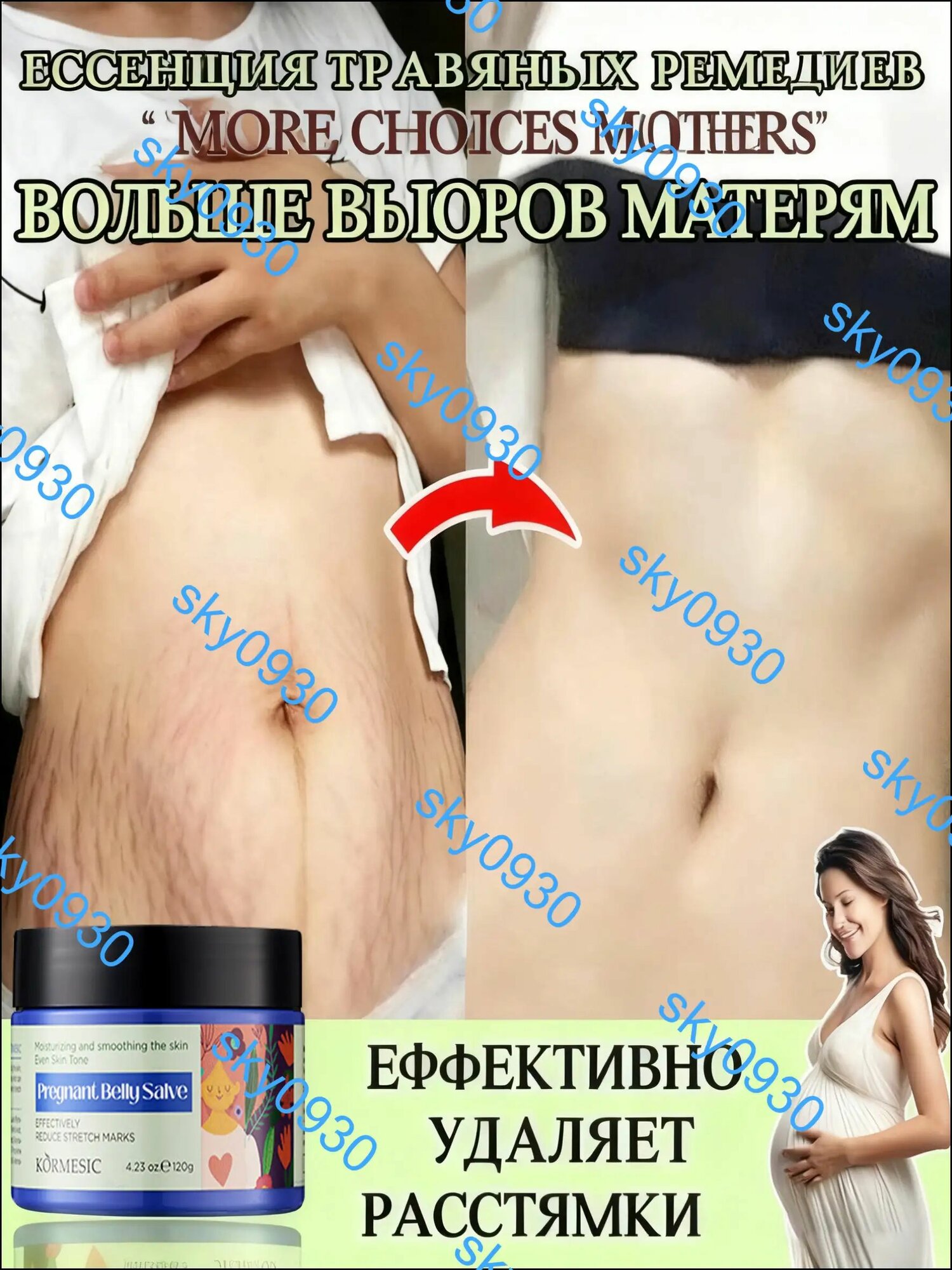 Средство от растяжек
