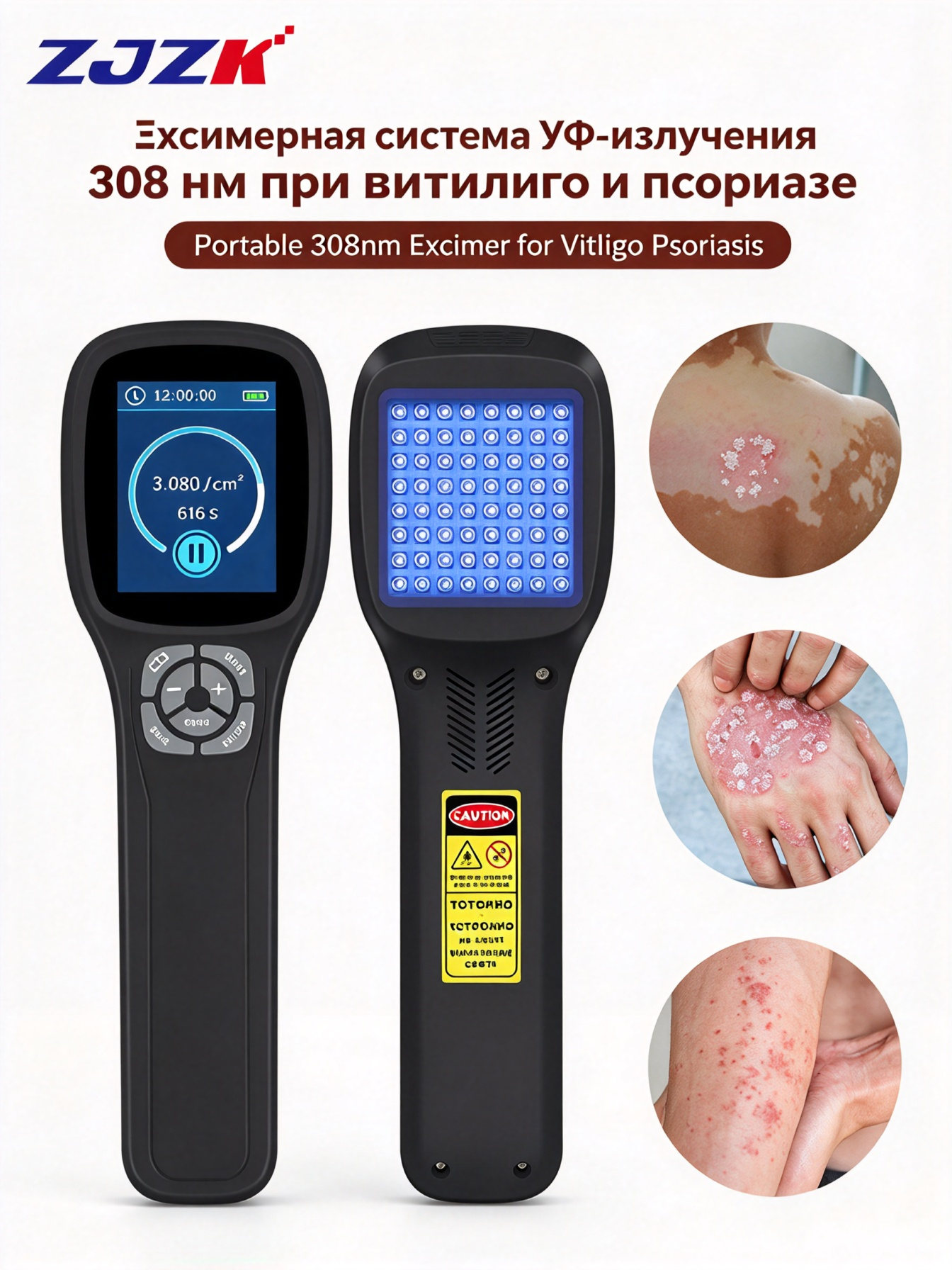ZJZK аппарат фототерапии ультрафиолетовым излучением типа В для лечения экземы, борется с шелушением кожи