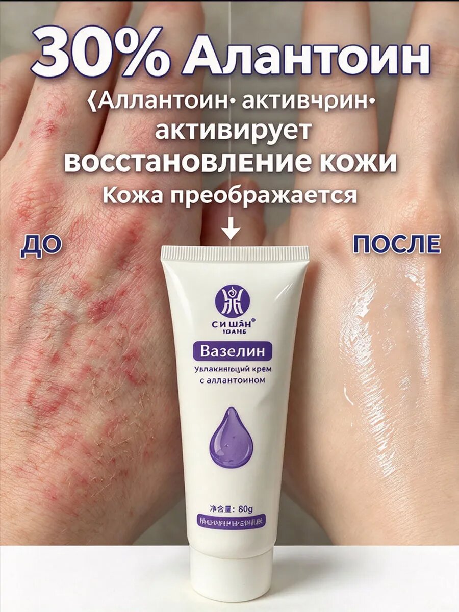 Уродерм с мочевиной 30% для пяток крем,80 г