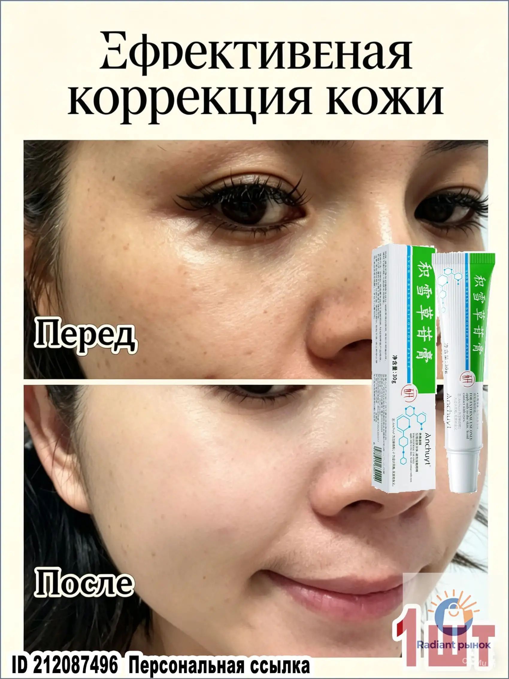 Крем травяной от акне для лица, 30 мл