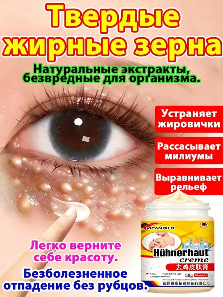Крем от милиумов от просянки белых угрей и роговых кист,50 г 1 шт.