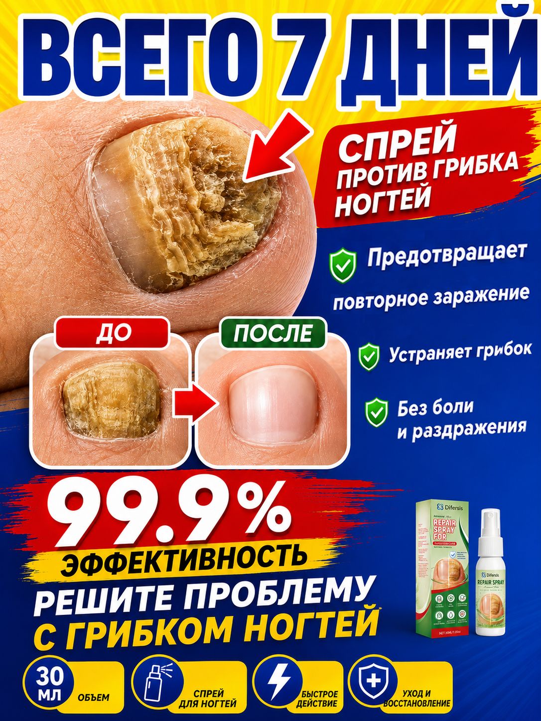 Спрей от грибка ногтей на ногах, для лечения плесневых инфекций, укрепления ногтей, удаления рогового слоя и устранения онихомикоза