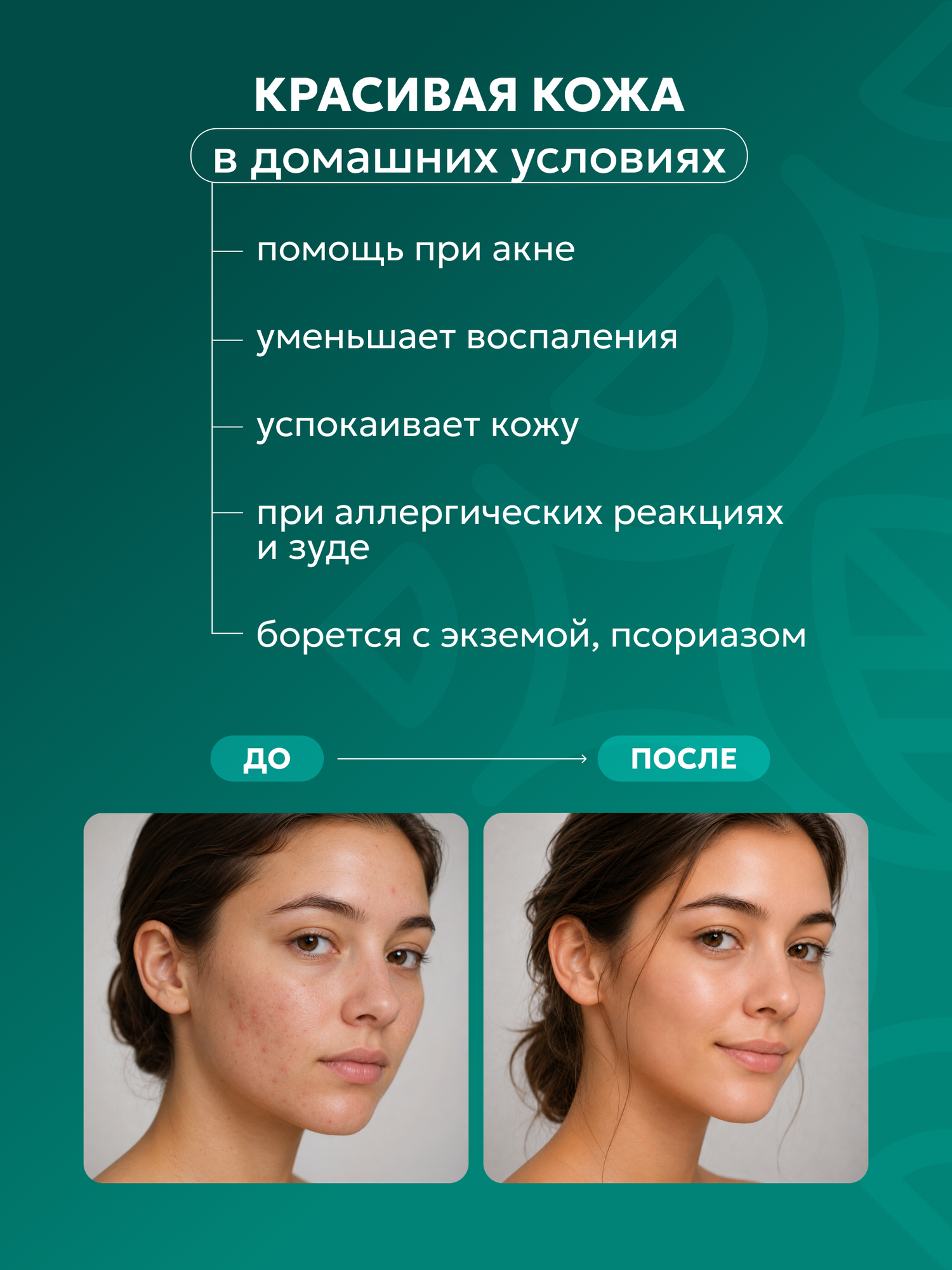 Масло чайного дерева 30 мл, натуральное средство для ухода — фото 1