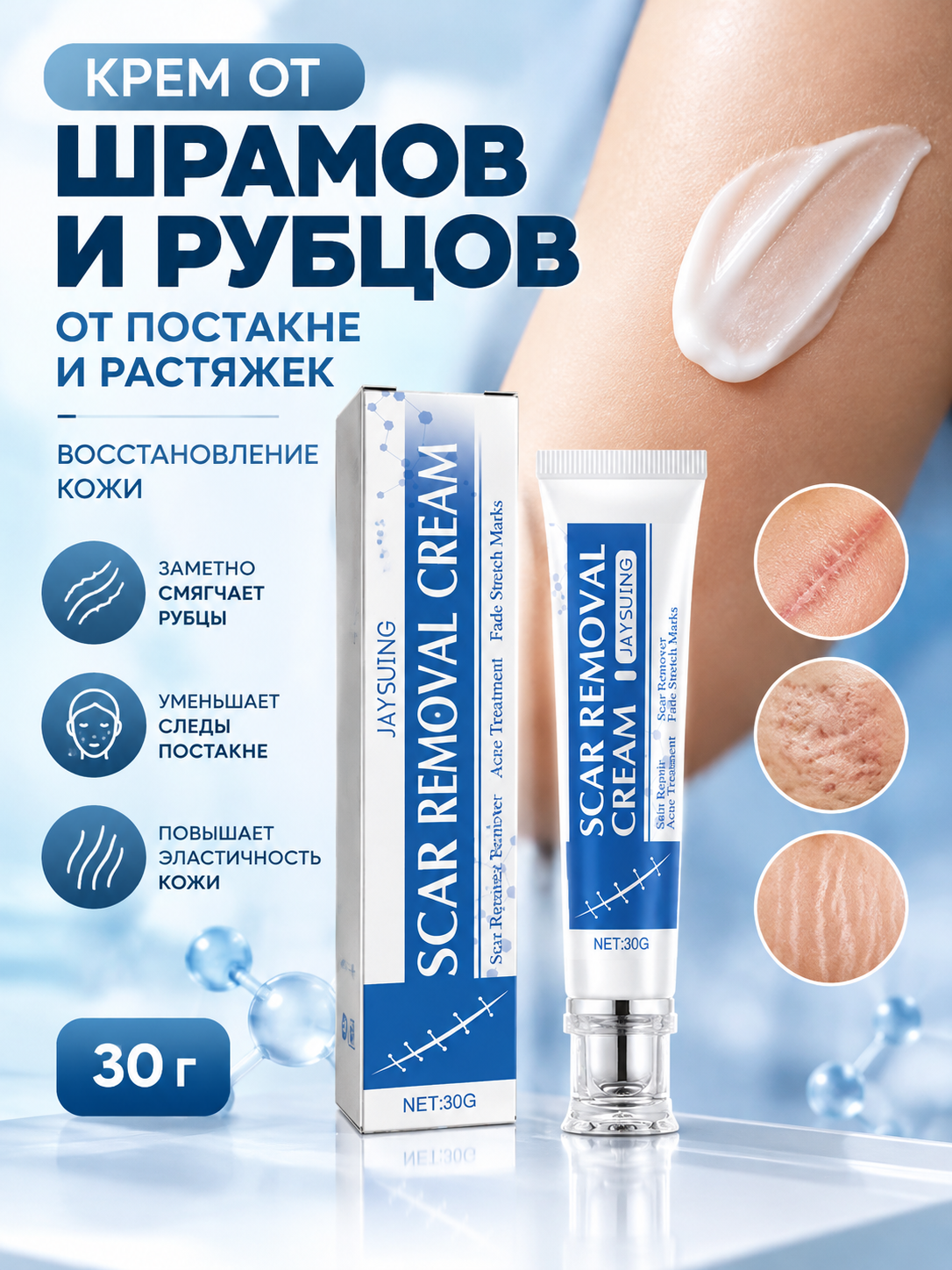 Крем от шрамов и рубцов, от постакне и растяжек, восстановление кожи, 30 г