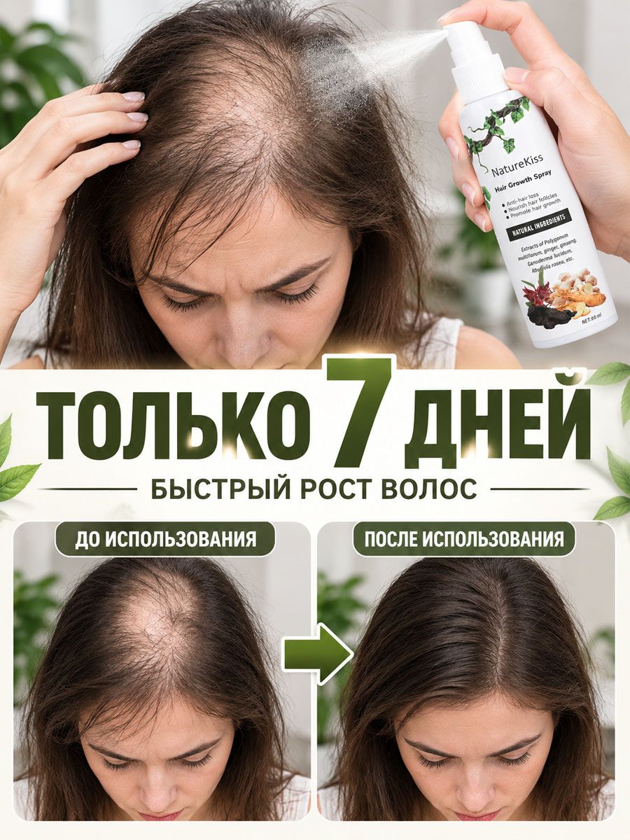 Спрей для роста волос, Тройная активация фолликулов: женьшень, полигонум, имбирь пробуждает спящие фолликулы,60 мл