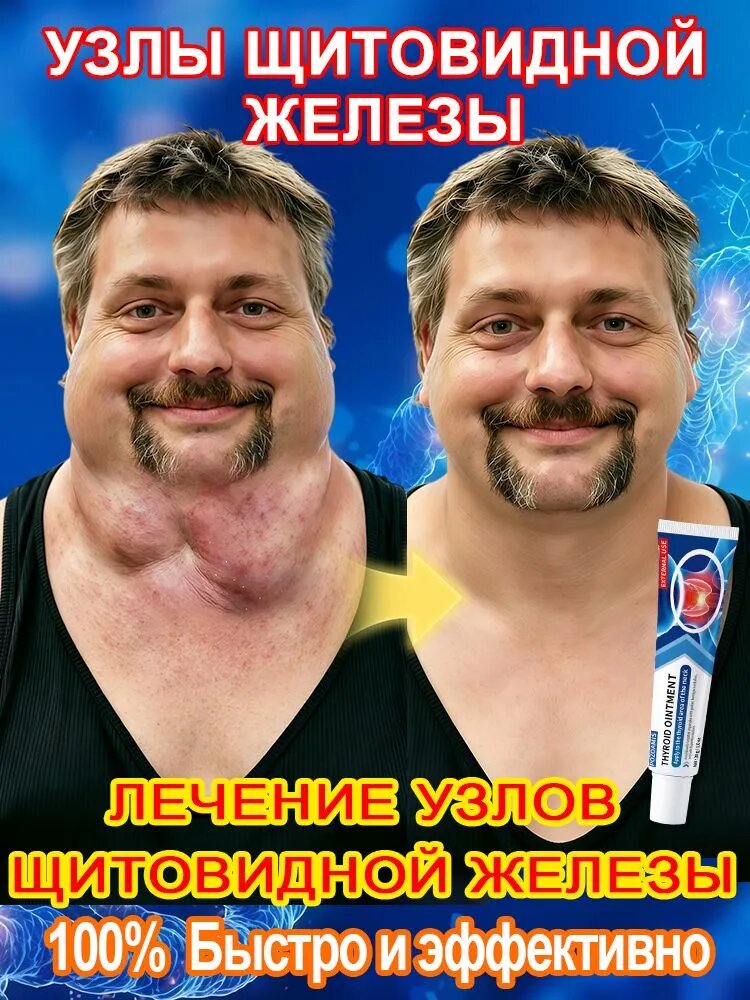 Крем от узлов щитовидной железы рассасывание уплотнений, снятие воспаления, улучшение кровообращения в области шеи. На основе натуральных экстрактов. 120 г