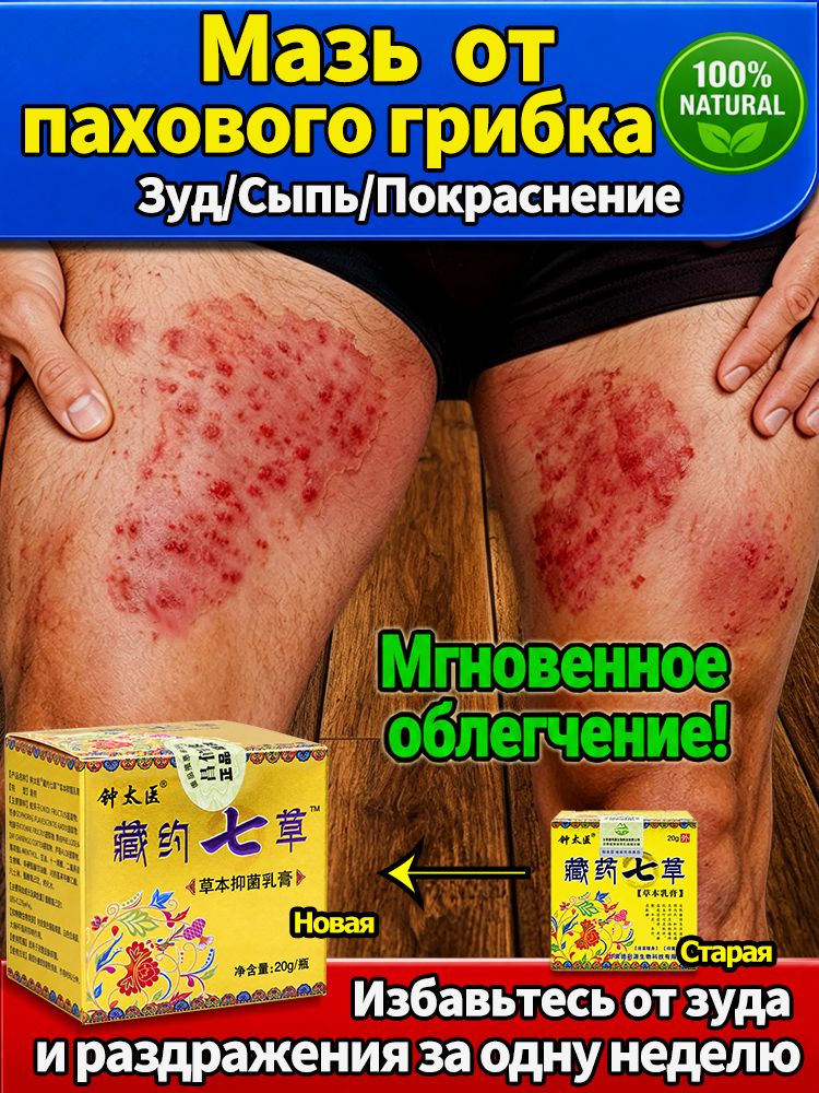 Паховый грибок противогрибковая мазь для кожи