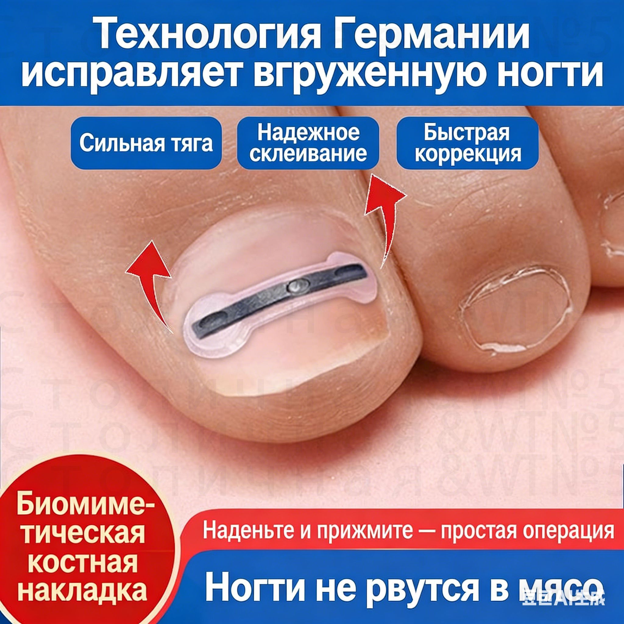 Набор для коррекции вросшего ногтя из никель-титанового сплава для домашнего лечения