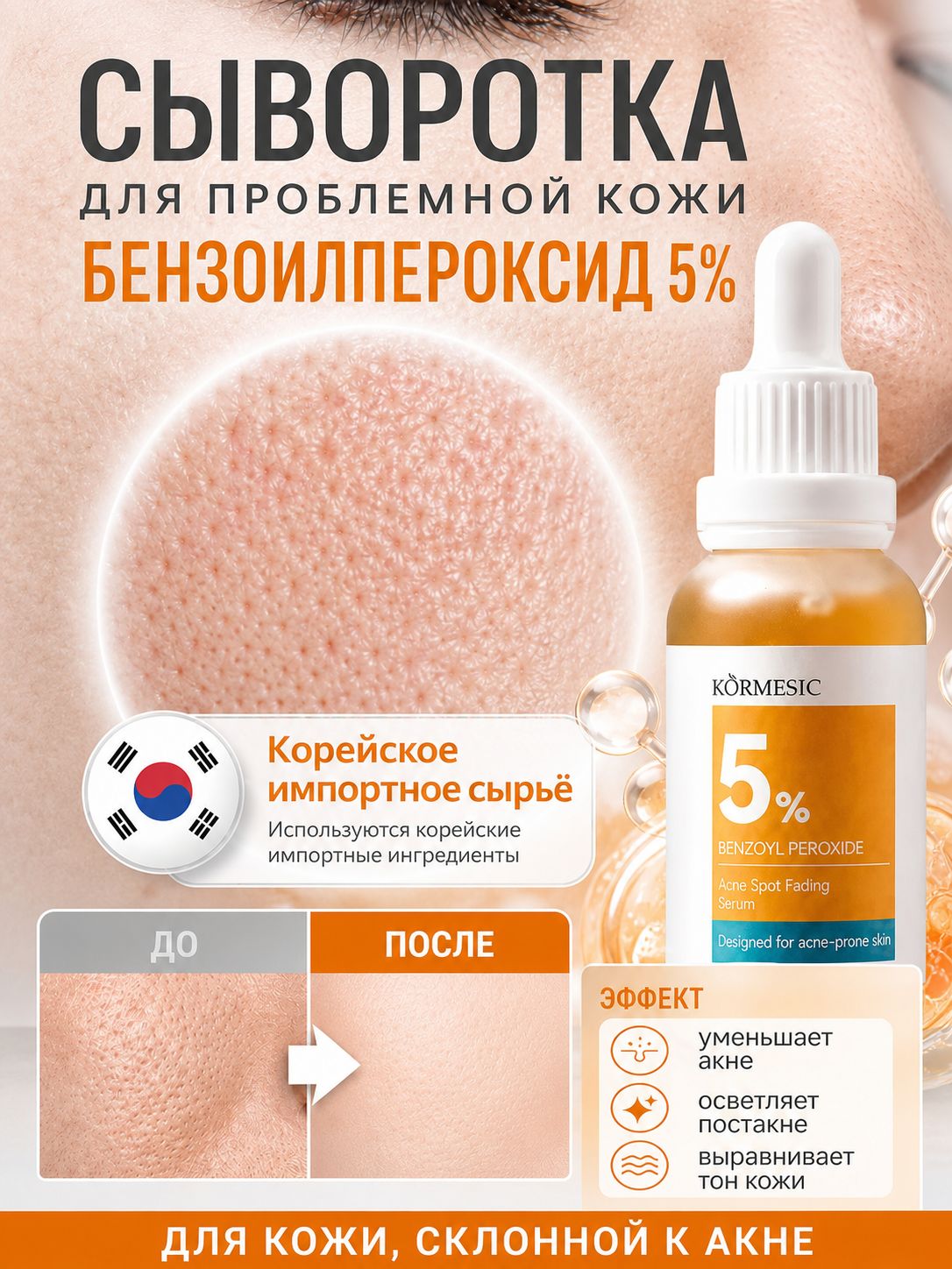 Cairang Сыворотка для лица от прыщей и акне с бензоил пероксидом 5%, SOS-средство против воспалений, 30 мл
