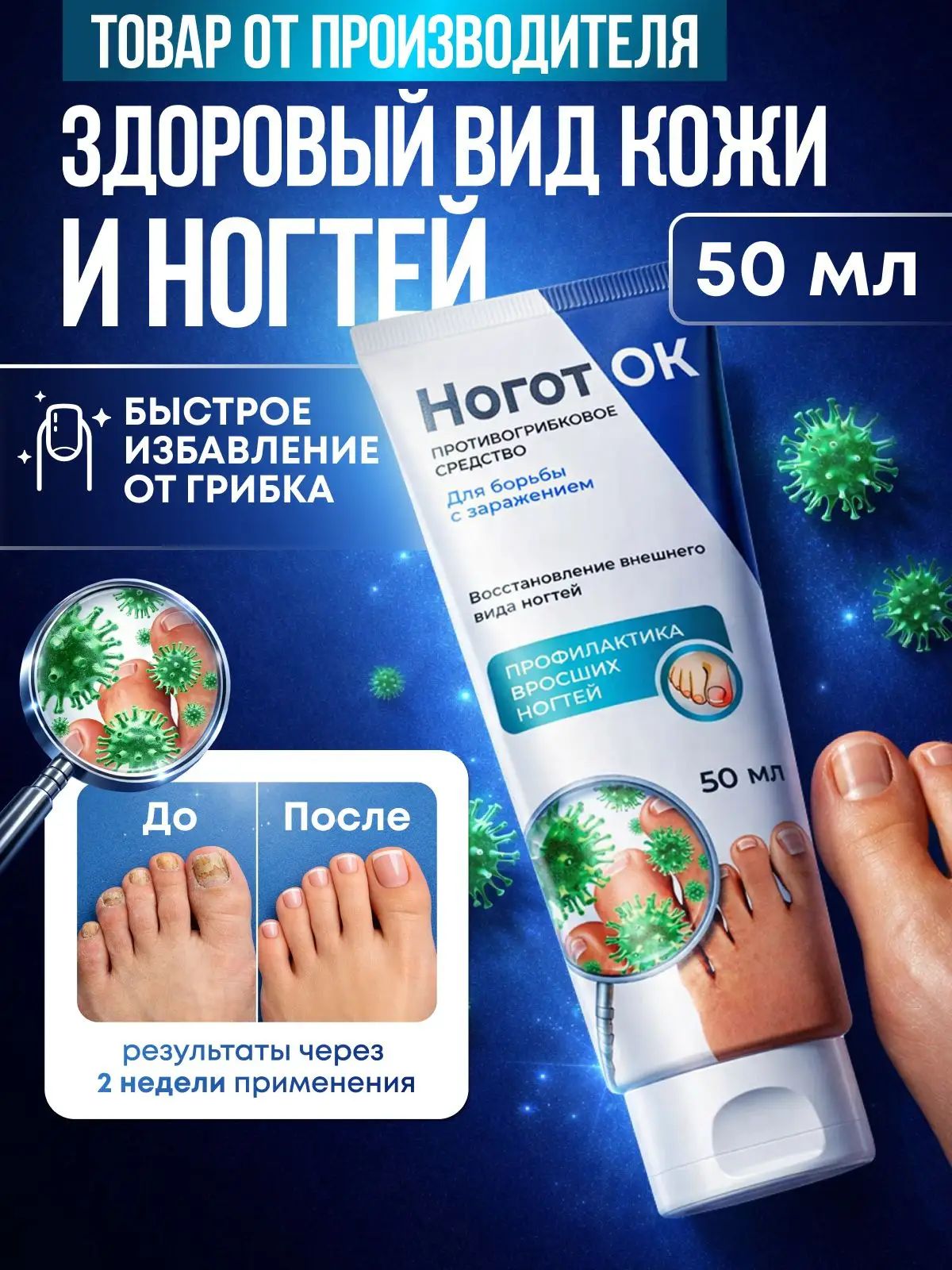 Противогрибковое средство от грибка ногтей Ноготок