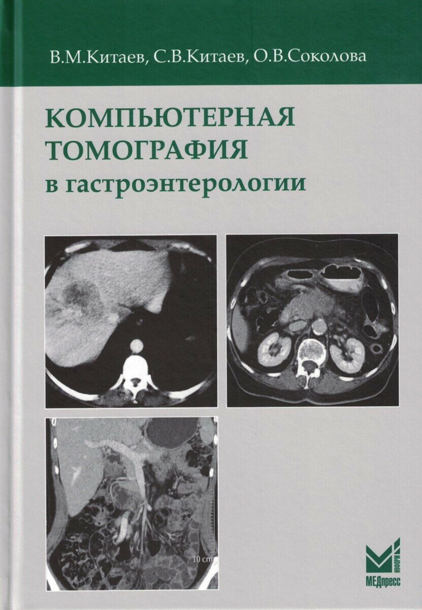 Компьютерная томография в гастроэнтерологии: руководство для врачей. 3-е изд, испр. и доп. Китаев В.