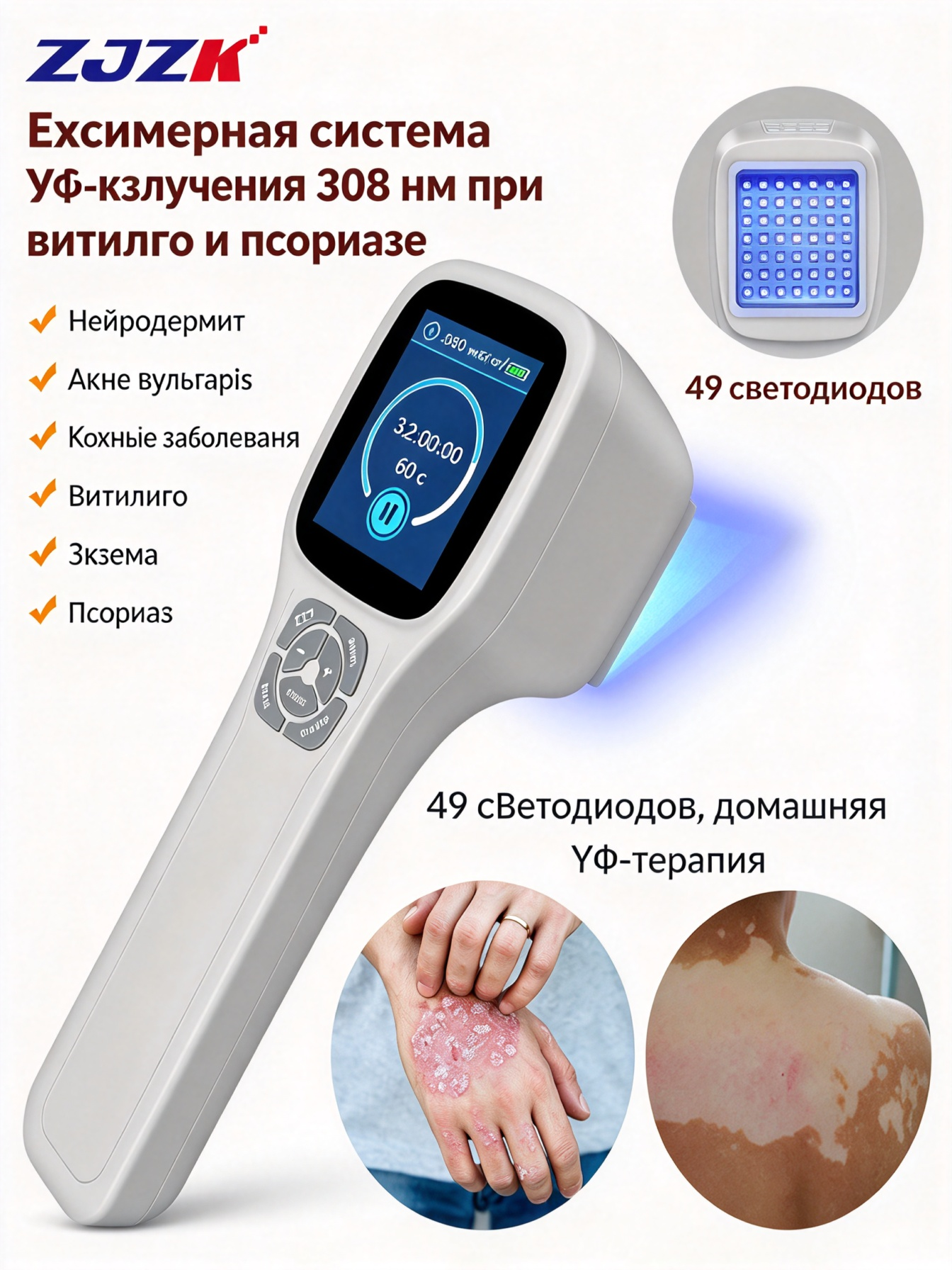 ZJZK Ультрафиолетовая лампа UVB 308 нм для фототерапии при атопическом дерматите, убирает папулы