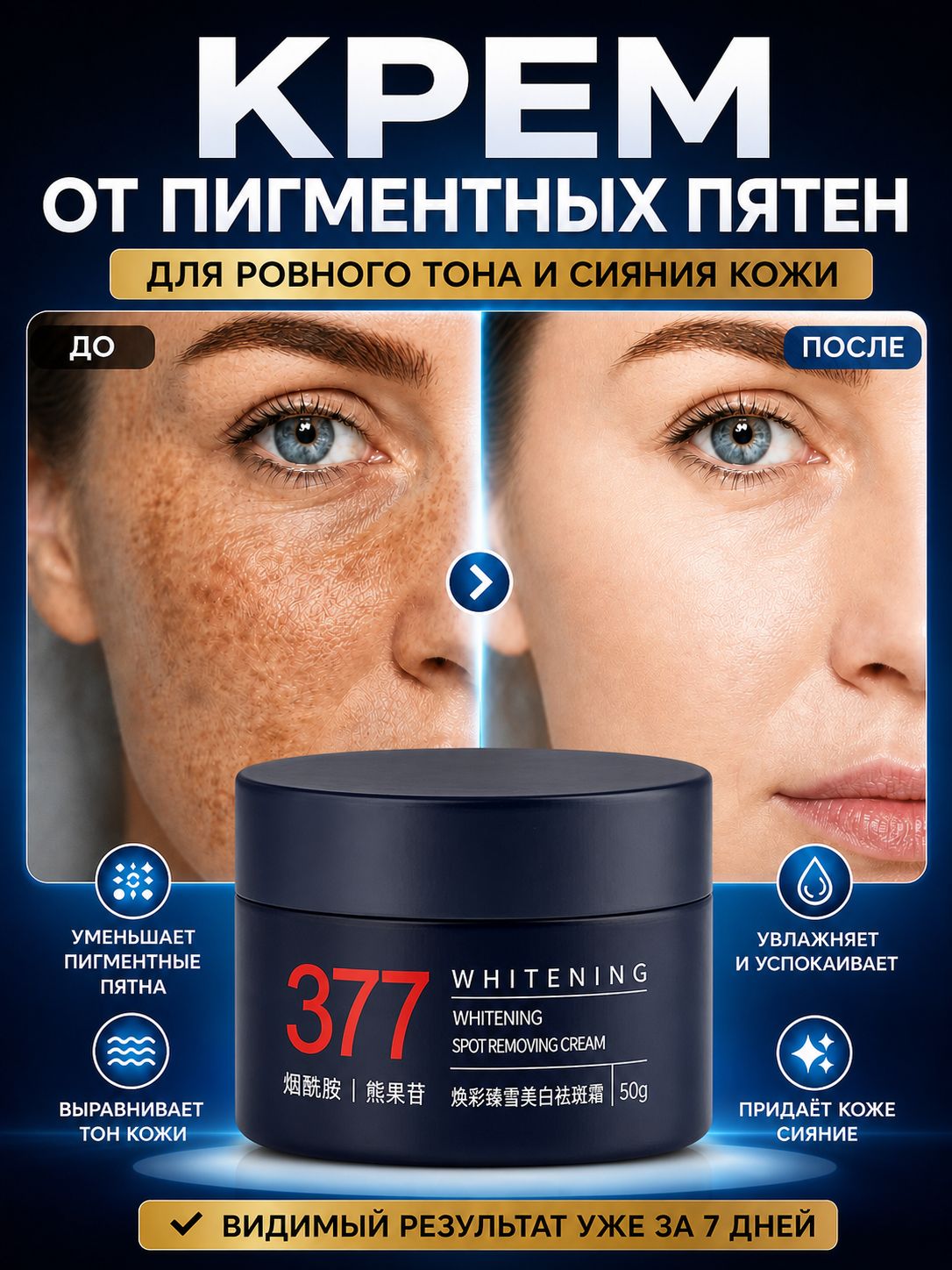 Крем от пигментных пятен на лице, 50 г , осветляет веснушки, старческие и пигментные пятна на лице.