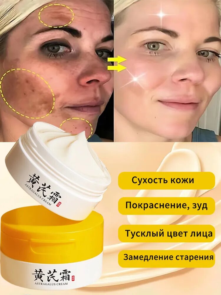 Крем для лица с астрагалом, отбеливающий веснушки, удаляет темные пятна, мелазму, осветляет меланин, рубцы от акне, омолаживает, осветляет к