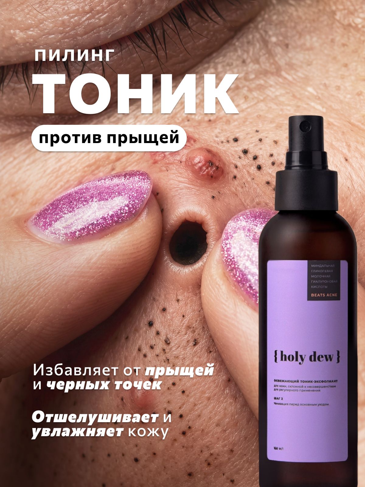HOLY DEW Тоник для лица и тела с ниацинамидом от прыщей и черных точек, 150 мл