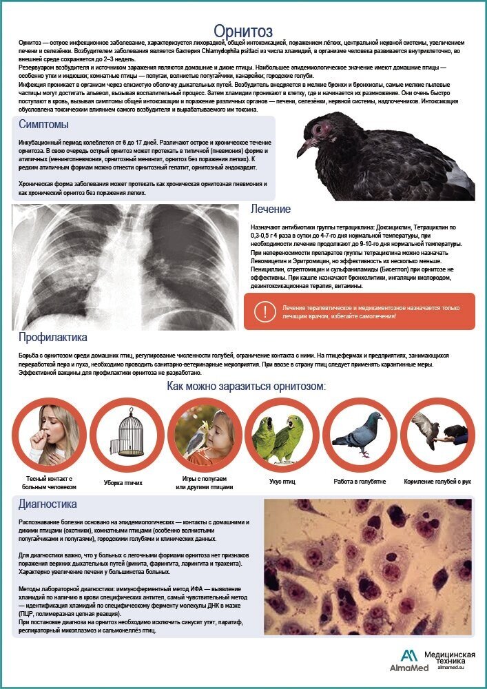 Орнитоз медицинский плакат глянцевая фотобумага от 200 г/кв. м, размер A2+