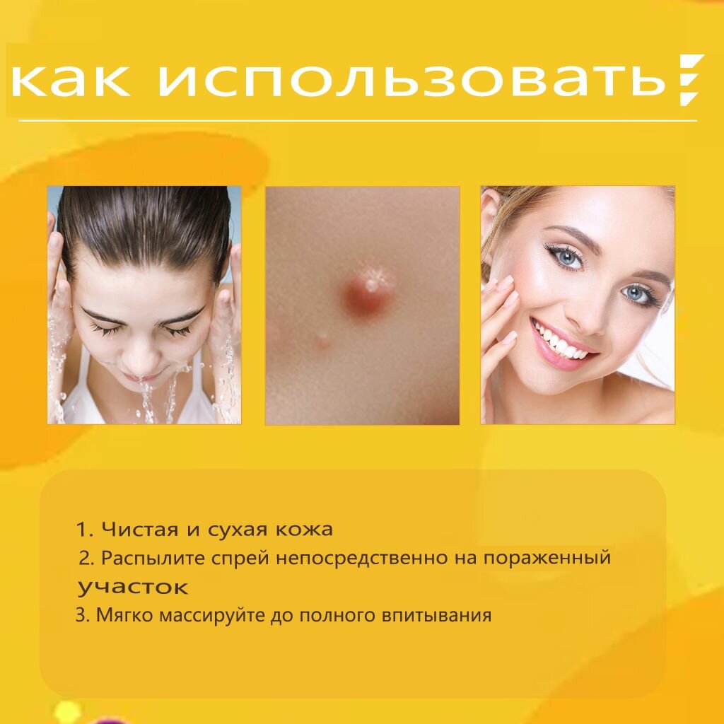 20ML Tag Recede Bee Venom, Средство от папиллом и бородавок, мазь для ухода за кожей 20 мл — фото 1