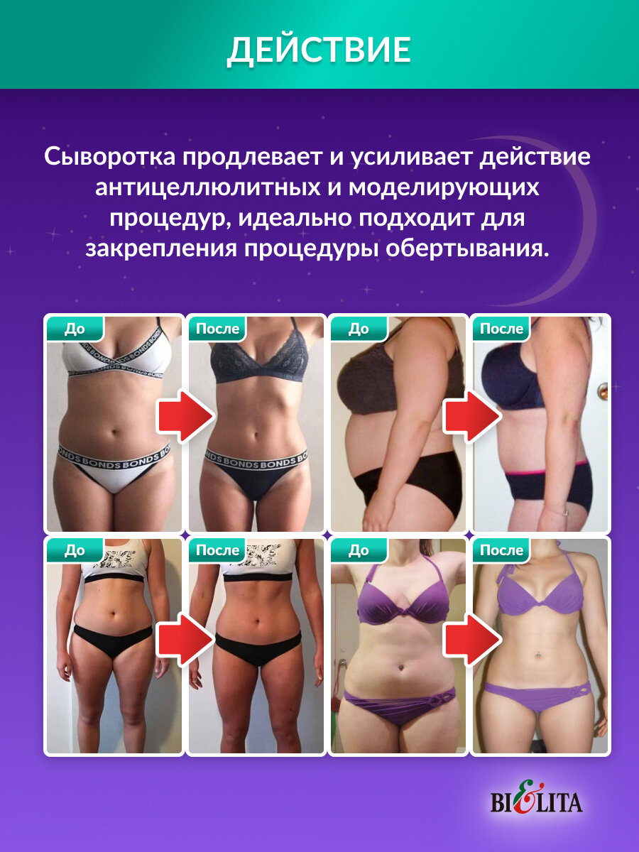 Белита Сыворотка для тела Vitex Ultra Slim, 400мл, антицеллюлитная несмываемая для коррекции фигуры (2 штуки по 200 мл) — фото 1