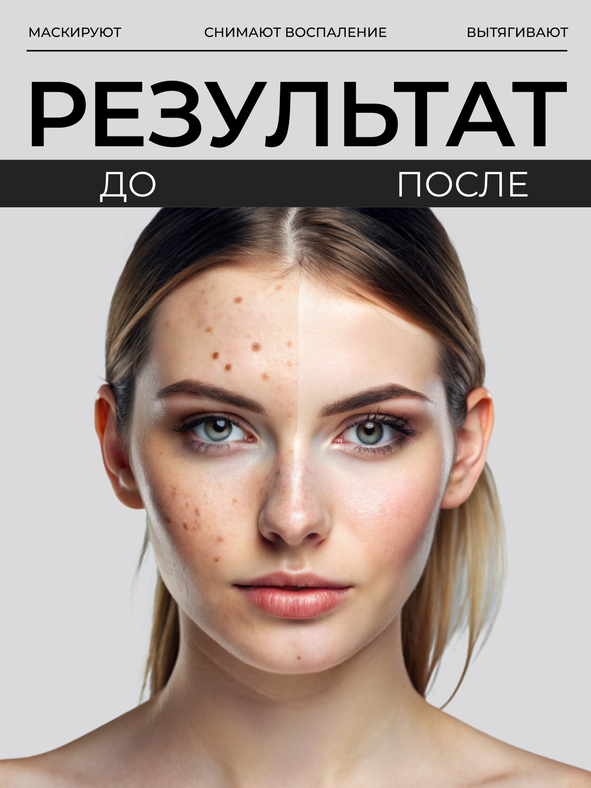 Изображение Ночные патчи от прыщей LANBENA, 28 шт /уход за лицом / Стикеры, пластырь от прыщей для лица ланбена / Средство от прыщей