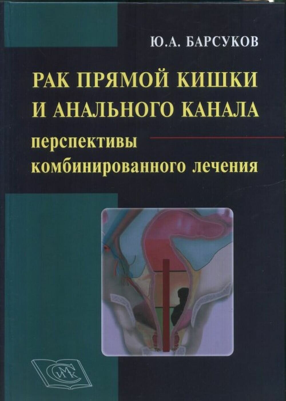 Книга Рак прямой кишки и анального канала: перспективы комбинированного лечения.