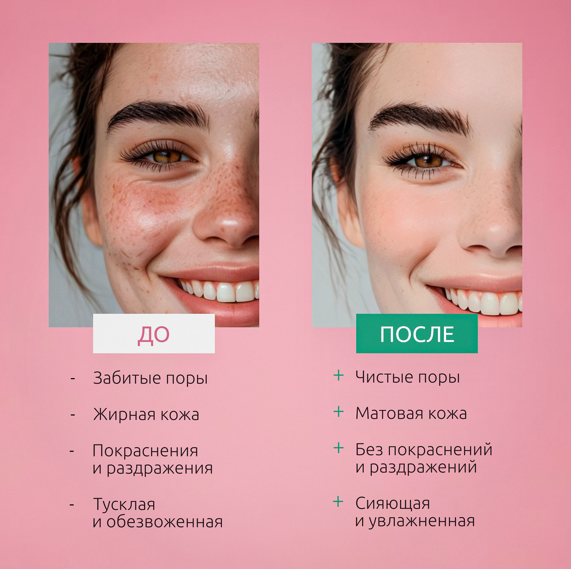 Пенка для умывания 150 мл с молочной кислотой, ALOE VERA и экстрактом ламинарии — фото 1