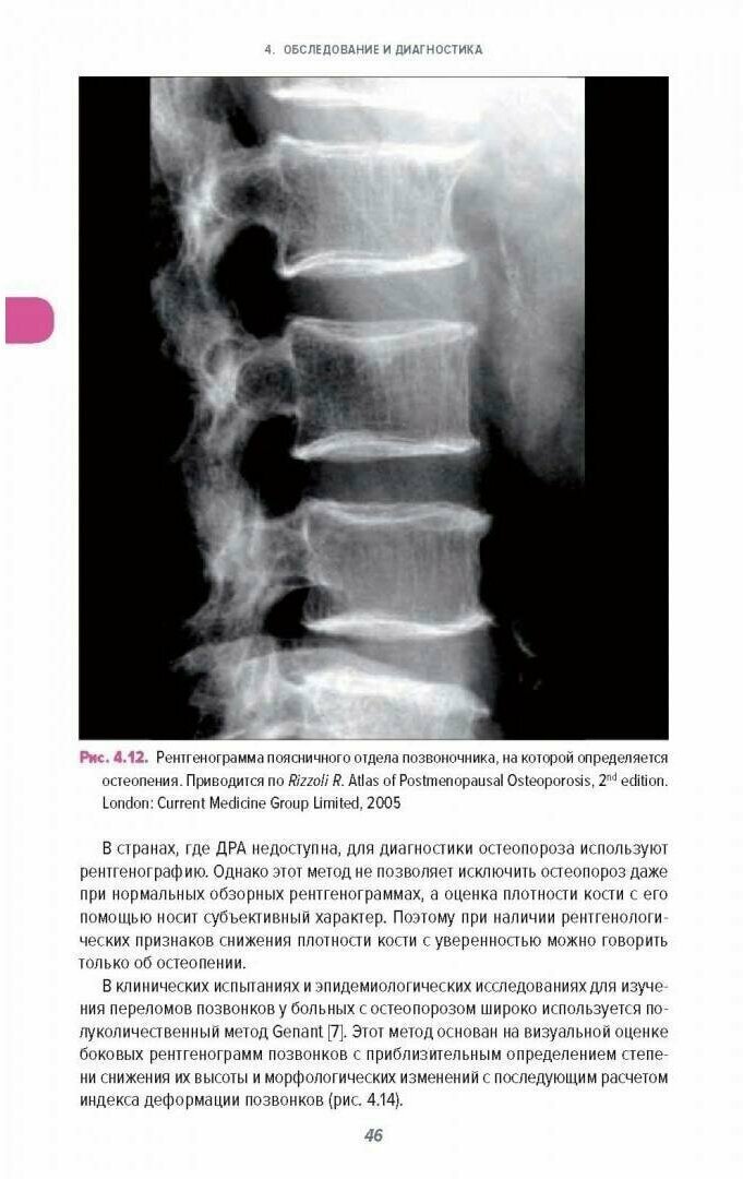 Справочник по остеопорозу (Рэйд Давид М.) - фото №14