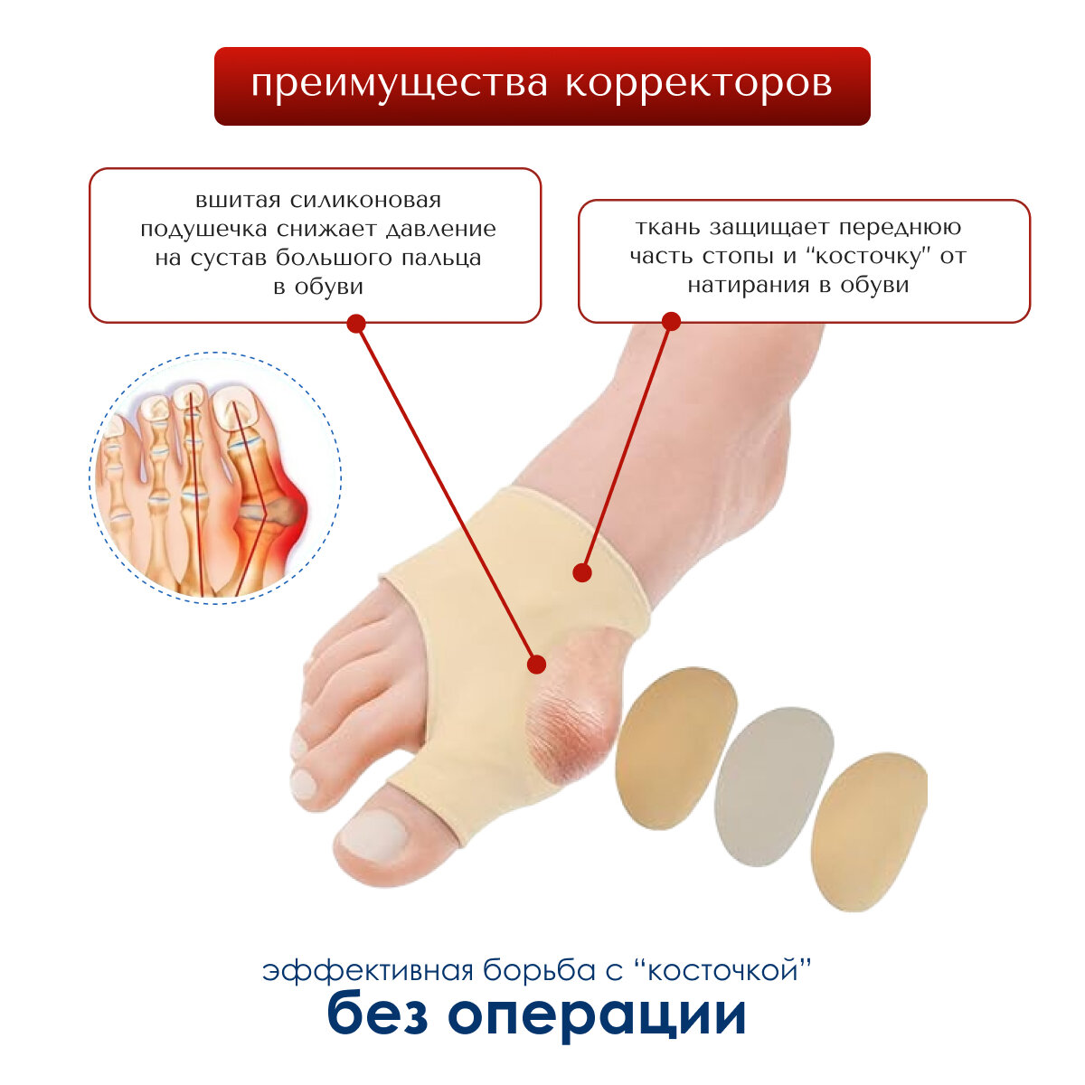 Изображение Тканевый бурсопротектор для большого пальца MyBalance гипоаллергенный, бежевый, от косточки на большом пальце
