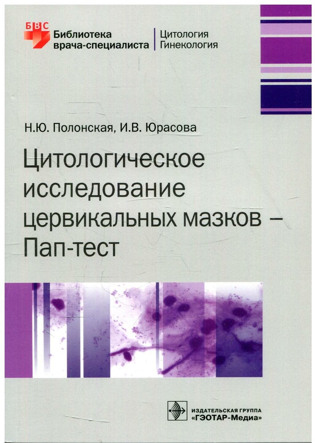 Цитологическое исследование цервикальных мазков - Пап-тест