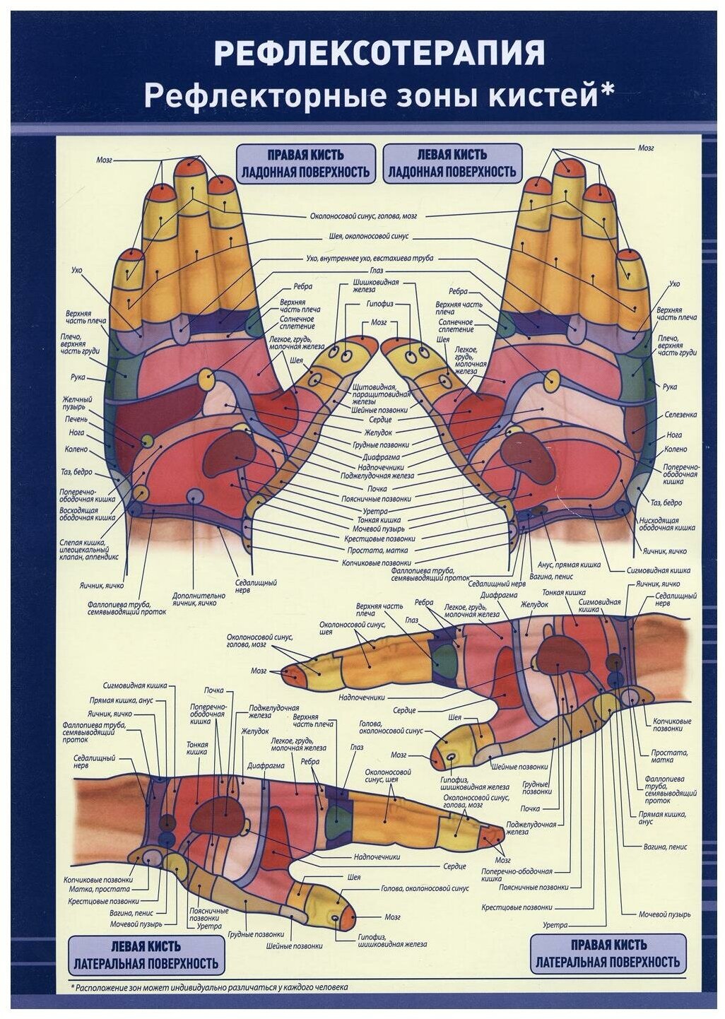Плакат "Рефлексотерапия. Рефлекторные зоны кистей". Полноцветный, двустронний. Формат А4