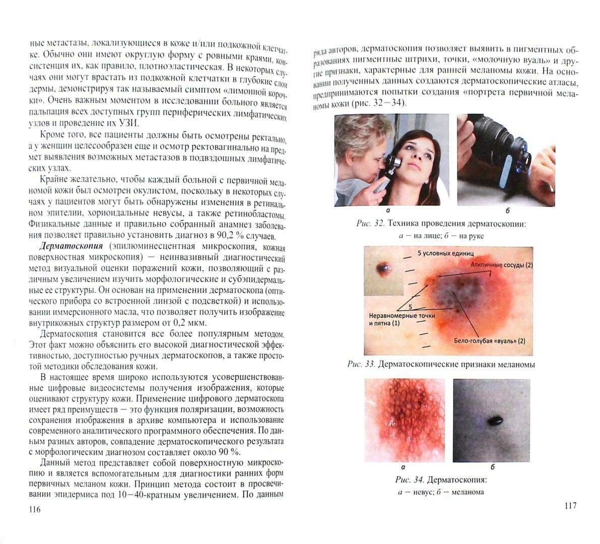 Злокачественные новообразования кожи. Клиника, диагностика, лечение и вопросы - фото №2
