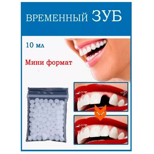 Материал пломбировочный временный (HOMTOPY). Пломба зубная для ремонта и самостоятельного изготовления, временные накладные и вставные зубы и виниры для зубов
