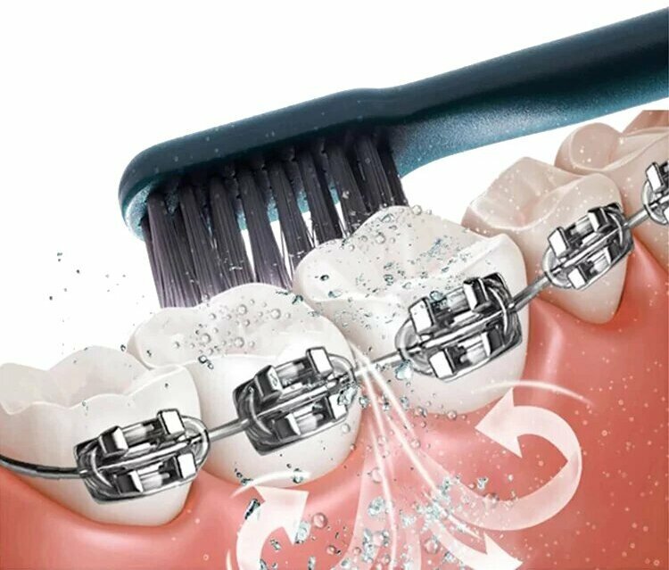 Электрическая зубная щётка со стерилизатором Xiaomi T-Flash UV Sterilization Toothbrush Green (Q-05) - фото №6