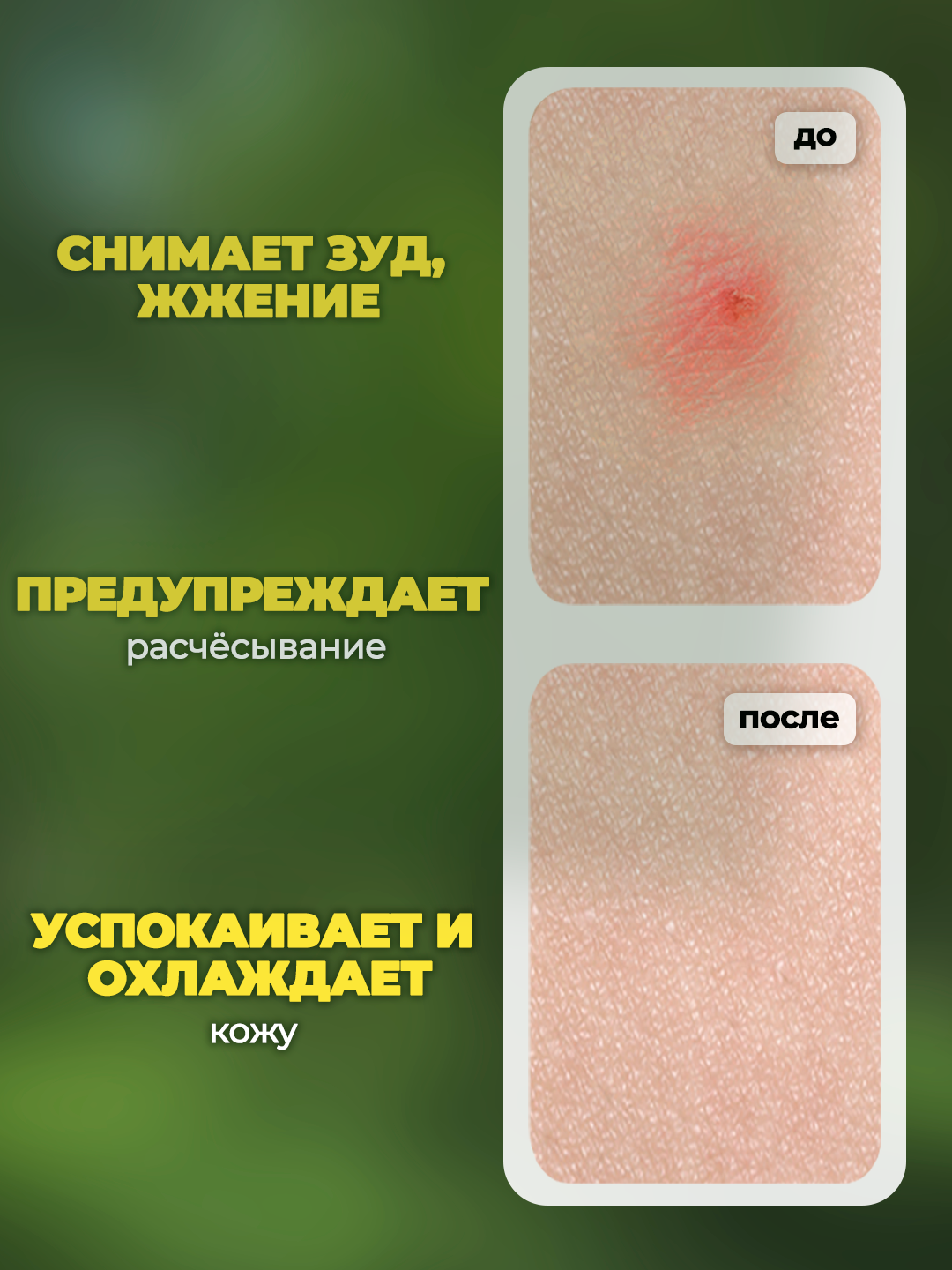 Изображение Прибор для снятия зуда и раздражения после укусов комаров и других насекомых