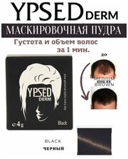 YpsedDerm Black (черный), 4 гр