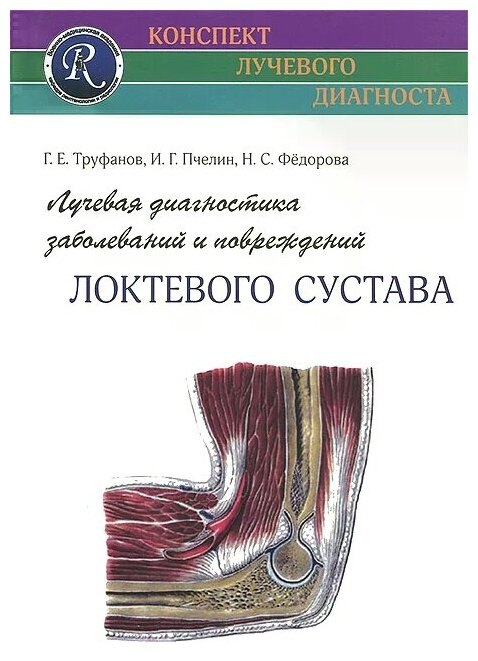 Лучевая диагностика заболеваний и повреждений локтевого сустава - фото №1