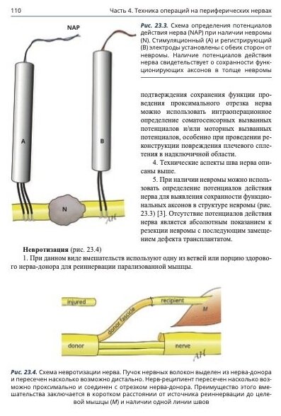 Анатомия спинномозговых нервов и доступы к ним - фото №11