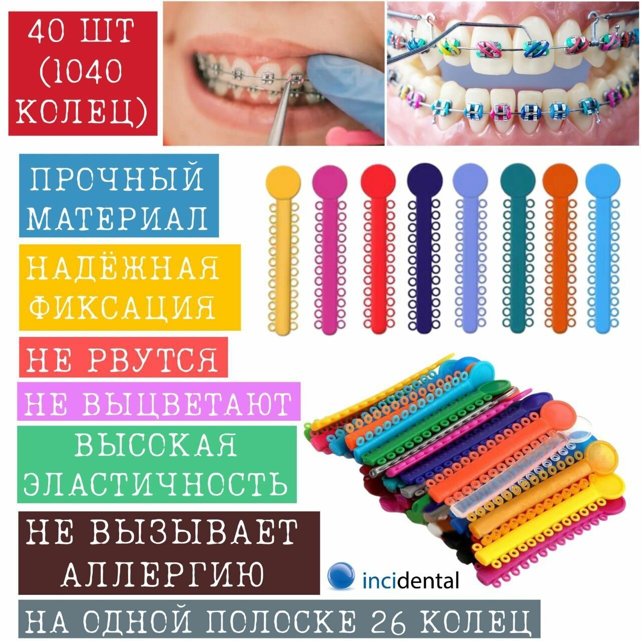 Эластичные ортодонтические Лигатуры Inci LIGATURE TIES // Лигатуры для брекетов 40 шт. ( модуль 1040 колец) , цветные . Инсидентал , Incidental .