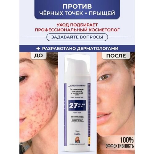 Vishell / Пилинг-маска от прыщей 27% Acid 50мл №27