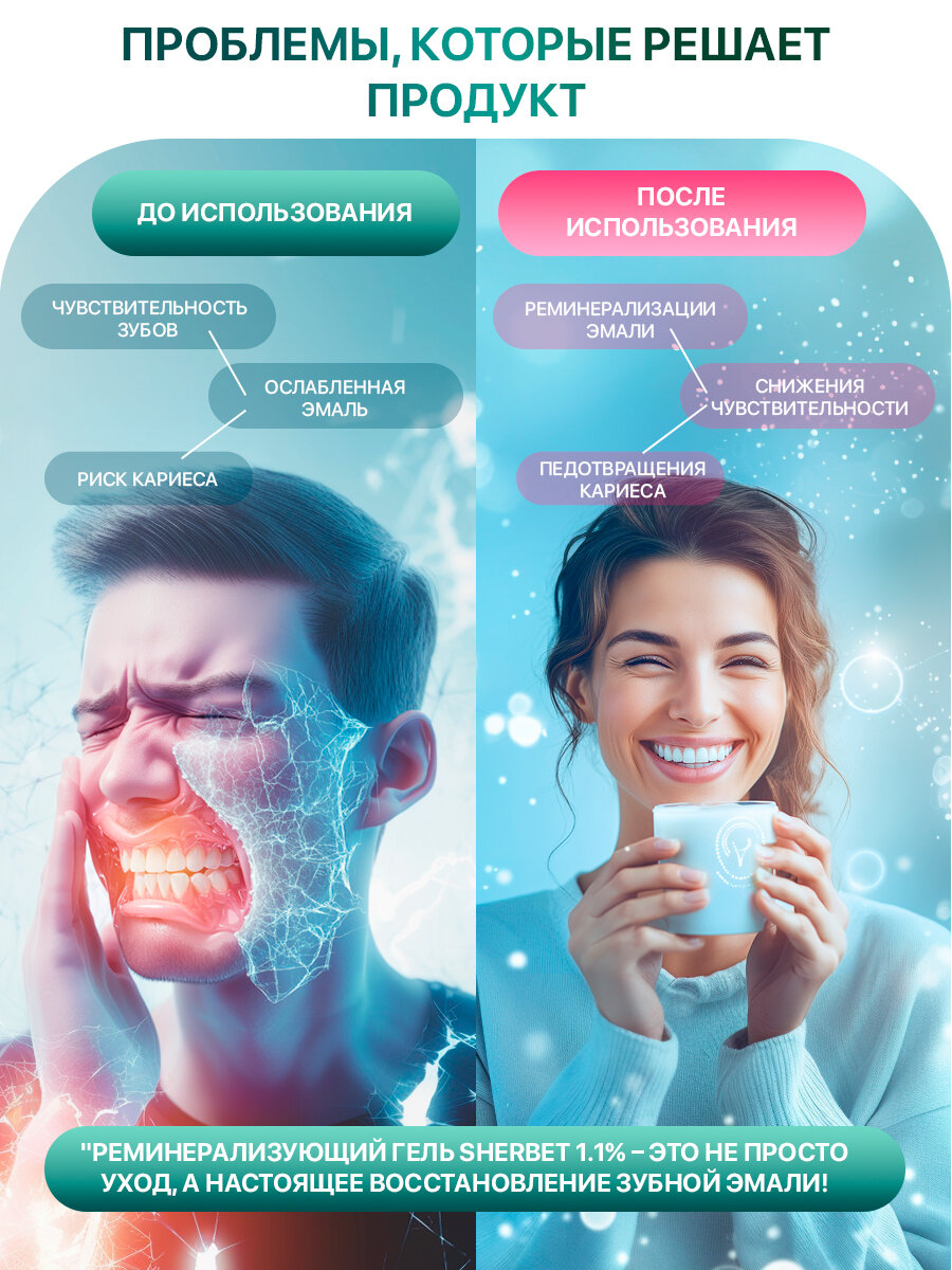 Гели Для Полости Рта Реминерализующий рН-Нейтральный гель Sherbet Neutral Fluoride Gel 1.1% ментоловый мусс, 120 г