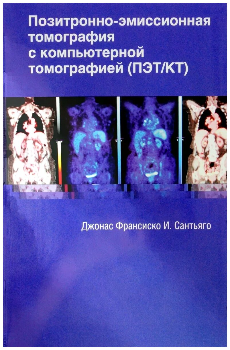 Позитронно-эмиссионная томография с компьютерной томографией (ПЭТ/КТ) - фото №1