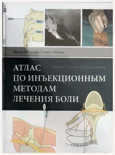 Изображение товара Атлас по инъекционным методам лечения боли