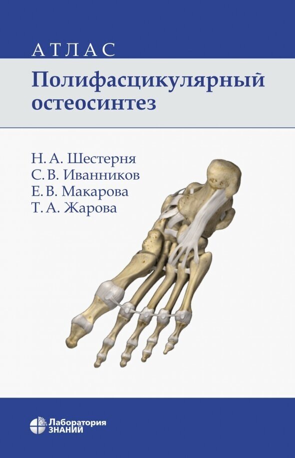 Полифасцикулярный остеосинтез. Атлас - фото №3