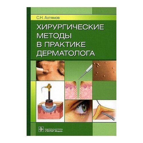 Хирургические методы в практике дерматолога - фото №3