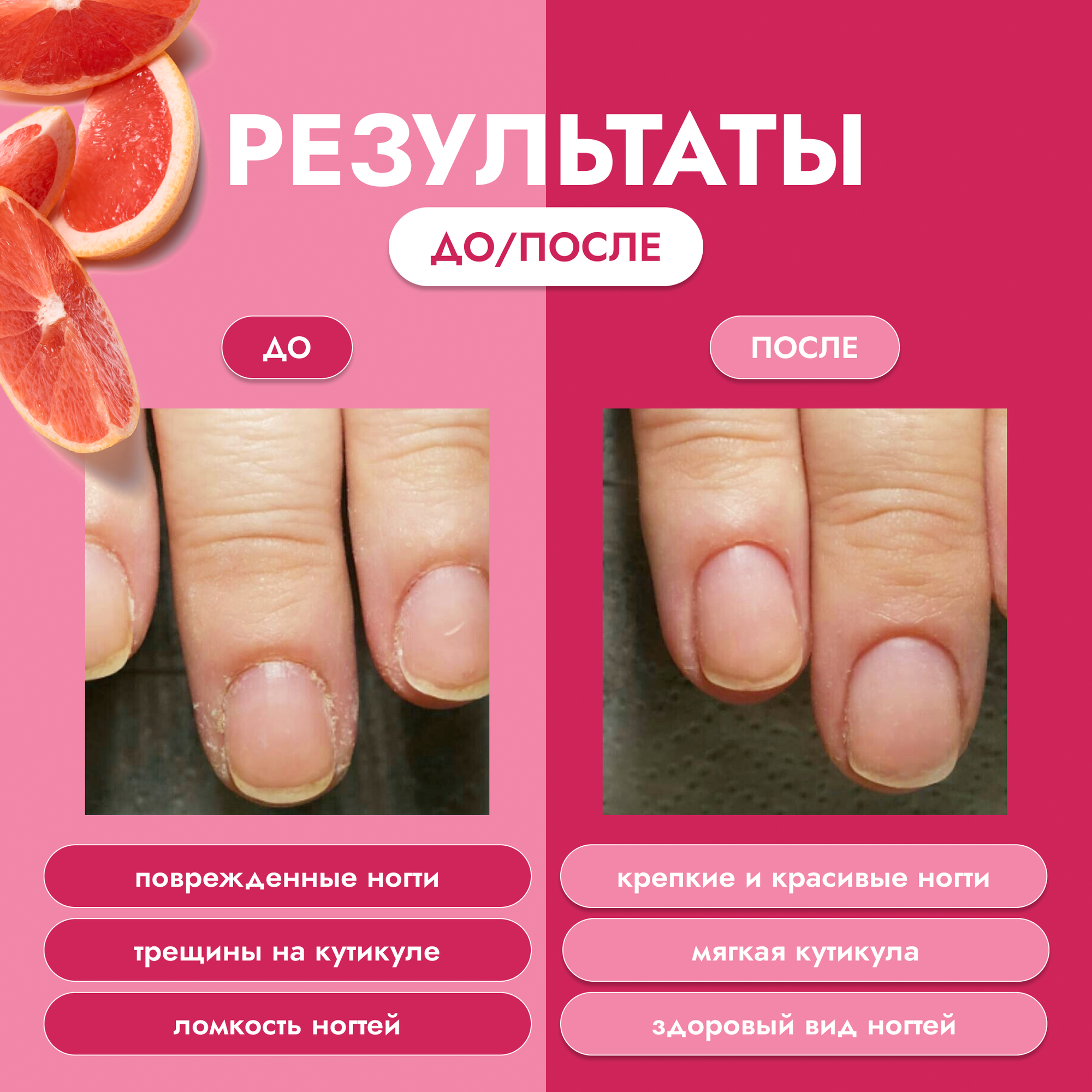 Средства Для Кутикулы Крем Холодный Парафин для Ногтей и Кутикул Восстанавливающий DNC 15 мл