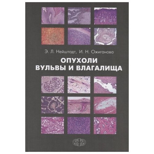 Нейштадт Э., Ожиганова И. "Опухоли вульвы и влагалища"