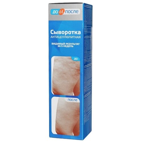 До и После Сыворотка Антицеллюлитная 130 мл 1 шт 522₽