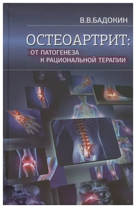 Остеоартрит от патогенеза к рациональной терапии - фото №2