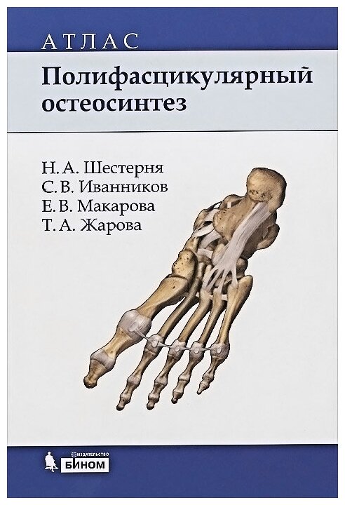 Полифасцикулярный остеосинтез. Атлас - фото №1