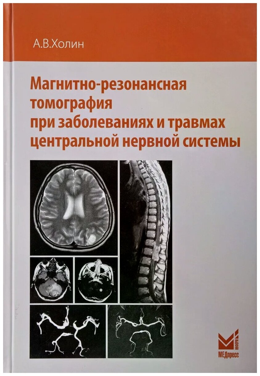 Магнитно-резонансная томография при заболеваниях и травмах центральной нервной системы - фото №1